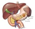 <b>splenic</b> artery or vein,
