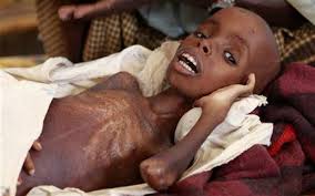 صور موثرة جدا جدا  لمأساة الصومال 2011 Images?q=tbn:ANd9GcQfd4ozNMaUophMS-IQ8WCJ7cxL4e_M9_nEXXxL9gg3d2b-5I7e1g