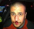 Trayvon Martin killer George Zimmerman has bloody lip in new photo ...
