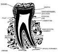 <b>secondary dentin</b> or by