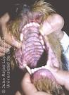 <b>Dermatopatías Vesiculoampollosas</b>; Enfermedades Ampollosas de la