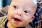 Down <b>Syndrom</b> Doesn't Keep Our