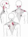 Neck And Shoulder Pain | Neck Shoulder Pain