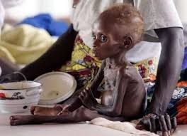 مجاعة الصومال .. اين انت ياعمر بن عبدالعزيز ؟؟ Images?q=tbn:ANd9GcR1RJEcKgUfA8Y9Z9mg3DBIm1RtcPE3U3thXVdC8wgbqg4vQZ6s4g