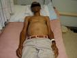 <b>Hepatomegaly</b>. Causes, symptoms, treatment <b>Hepatomegaly</b>