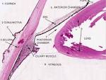 into the <b>anterior chamber</b>
