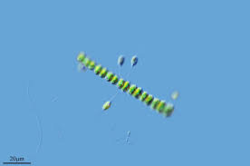 Image result for Rhizounochloridaceae