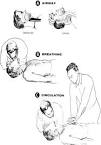 The ABCs of <b>resuscitation</b>.