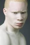 ALBINO Wonders on Pinterest | 469 Photos on albinism, albino model.