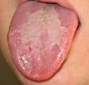 A <b>língua</b> é um órgão formado
