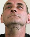 Mark Wells. Fairfax NZ. STITCHED UP: Mark Wells feels he had a lucky escape. - 7823264