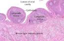 with <b>lymphoid tissue</b>