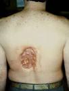 that <b>radiation injuries</b>