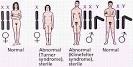 Human <b>sex chromosome</b>