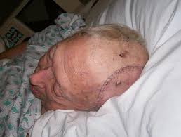 Elder Abuse of Clara G Fernandez - the other side Elder Abuse of Clara G Fernandez - the other side