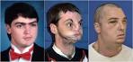 Gun Accident Victim Lee Norris's Face Transplant: Four Others Who ...