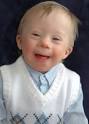 boy with Downs <b>syndrom</b>