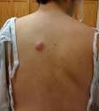 <b>Cysts</b> are growths that can