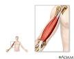 Charley horse · <b>Muscle cramps</b>
