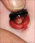 The <b>umbilical cord</b> of a