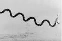 Syphilis (<b>Treponema</b> pallidum)