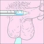 <b>phentolamine</b> Injection