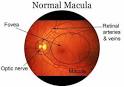 MACULAR DEGENERATION: Frequently Asked Questions - Duke Eye Center ...