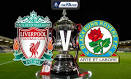 FA Cup Preview : Liverpool Vs Blackburn - Essentially Sports