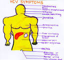 Hepatitis Symptoms
