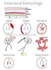 <b>Intracranial hemorrhages</b> are