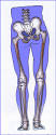 with <b>leg length inequality</b>