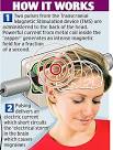 Dr Hans-Christoph Diener, a headache expert from Germany, cautioned that ...