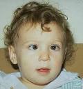 <b>Esotropia</b>