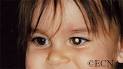 <b>Retinoblastoma</b> is the most