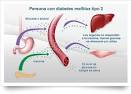 <b>diabetes mellitus tipo 2</b>,