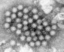 NOROVIRUS Infection Symptoms, Treatment, Prevention of Outbreaks ...