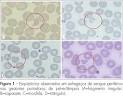 como <b>contagem</b> de <b>plaquetas</b>