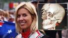 How woman survived brutal Formula One crash - Yahoo Autos