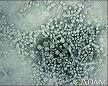image of <b>hepatitis B</b> virus