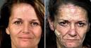 Go Back to the Before and After Crystal Meth Photos Mainpage - meth%20addict4