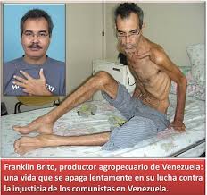 Venezuela: Empeora la salud de Franklin Brito, en huelga de hambre para que Chávez lo escuche Images?q=tbn:ANd9GcSaFz6lA9v02zoSmd5LnV3Rvrs0_7Vmm6k60Qmwz6fJpx35mnQ&t=1&usg=__PFimgjzC5HfuQi-1liES6mOQbyU=