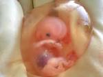File:Human <b>fetus</b> 10 weeks with