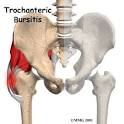 outside of the <b>hip</b> bone is