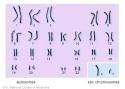 The other two <b>chromosomes</b>,
