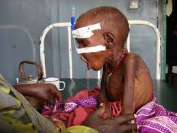 صور أطفال الصومال .. وهم يستغيثون Images?q=tbn:ANd9GcSmPYBi7Z3KlYJ86_Hxv4h3d337FN4tS1PGkp_f5QC-8FGjNvzM