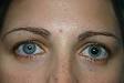 <b>Anisocoria</b> | Lehigh Valley Center for Sight
