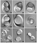 Sporulated oocysts of <b>Isospora</b>