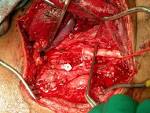 Trauma.org | Gunshot to Carotid Artery