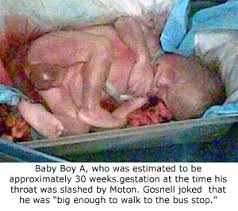 Baby A Baby A