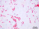 <b>Serratia marcescens</b> on